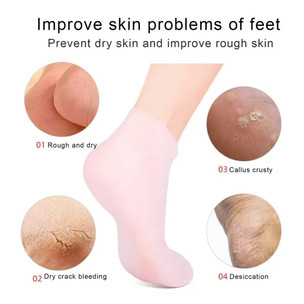 Silicone Moisturizing Gel Heel Socks